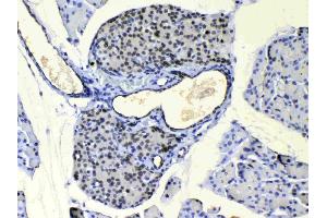 IHC analysis of COPE using anti-COPE antibody . (COPE antibody  (AA 80-308))