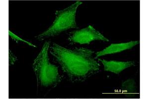 Immunofluorescence of monoclonal antibody to HSFY2 on HeLa cell. (HSFY2 antibody  (AA 1-100))