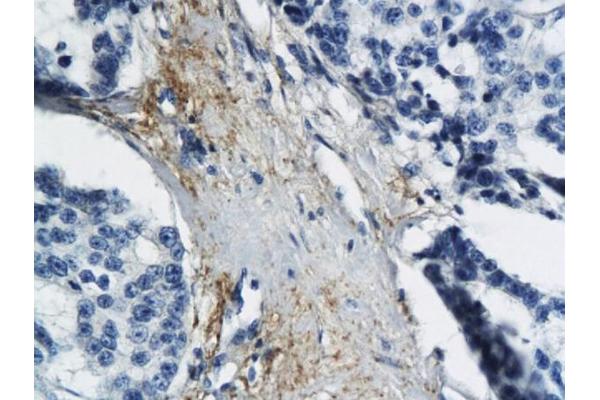 MT-ND6 antibody  (AA 51-150)