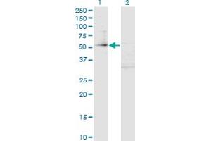 Western Blot analysis of ZFP161 expression in transfected 293T cell line by ZFP161 monoclonal antibody (M02A), clone 4F7. (ZBTB14/ZFP161 antibody  (AA 311-420))