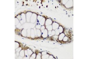 Immunohistochemistry of paraffin-embedded human gastric using NCL antibody at dilution of 1:200 (40x lens). (Nucleolin antibody)