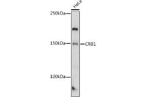 Western blot analysis of extracts of HeLa cells, using CRB1 antibody (ABIN7266524) at 1:1000 dilution. (CRB1 antibody  (AA 20-200))