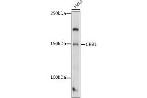 Western blot analysis of extracts of HeLa cells, using CRB1 antibody (ABIN7266524) at 1:1000 dilution.
