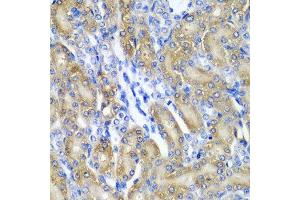 Immunohistochemistry of paraffin-embedded rat kidney using CRYAA antibody at dilution of 1:200 (40x lens). (CRYAA antibody)