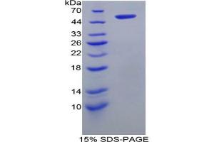 SDS-PAGE analysis of Rat FATP5 Protein. (SLC27A5 Protein)