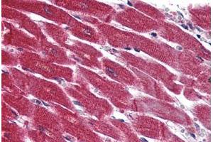 Anti-EDG3 / S1P3 antibody  ABIN1048532 IHC staining of human heart. (S1PR3 antibody  (N-Term))