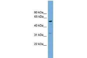 WB Suggested Anti-RSAD1  Antibody Titration: 0. (RSAD1 antibody  (Middle Region))