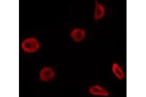 ABIN6275805 staining Hela by IF/ICC. (Topoisomerase I antibody  (Internal Region))