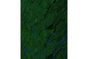 Immunofluorescence analysis of mouse heart cells using TNNI3 antibody (ABIN6132730, ABIN6149358, ABIN6149360 and ABIN6222761) at dilution of 1:100. (TNNI3 antibody  (AA 1-210))