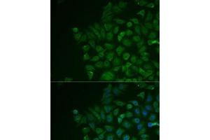 Immunofluorescence analysis of MCF7 cells using LRat Polyclonal Antibody (LRAT antibody)