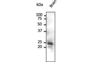 Western Blotting (WB) image for anti-RAB9B, Member RAS Oncogene Family (RAB9B) (C-Term) antibody (ABIN1440002)