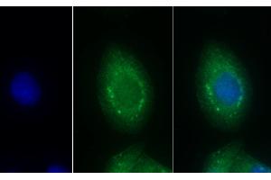 Detection of EDN1 in Human Hela cell using Monoclonal Antibody to Endothelin 1 (EDN1) (Endothelin 1 antibody  (AA 53-203))