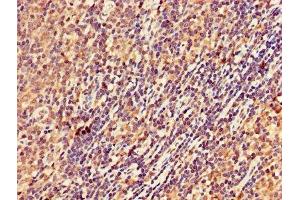 IHC image of ABIN7168978 diluted at 1:300 and staining in paraffin-embedded human lymph node tissue performed on a Leica BondTM system. (DRAK2 antibody  (AA 235-366))