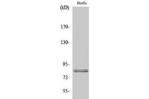 Western Blotting (WB) image for anti-Lipase, Hormone-Sensitive (LIPE) (Ser774) antibody (ABIN3175557) (LIPE antibody  (Ser774))