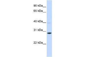 PGAM2 antibody used at 1 ug/ml to detect target protein. (PGAM2 antibody)