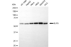 Western blotting analysis using ELP3 antibody (ABIN7798434). (Recombinant ELP3/KAT9 antibody)