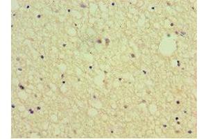Immunohistochemistry of paraffin-embedded human brain tissue using ABIN7168802 at dilution of 1:100 (SEMA4C antibody  (AA 749-833))