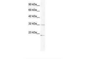 Image no. 1 for anti-Zinc Finger Protein 265 (Zranb2) (AA 33-82) antibody (ABIN203057) (ZNF265 antibody  (AA 33-82))