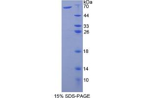 Prothrombin Fragment 1+2 (F1+2) (AA 44-327) protein (His tag,GST tag)