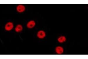 ABIN6278642 staining Hela by IF/ICC. (GTF3C3 antibody)