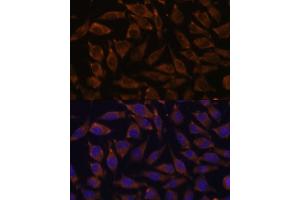 Immunofluorescence analysis of L929 cells using NOTCH2 antibody (ABIN6132419, ABIN6144736, ABIN6144737 and ABIN6213887) at dilution of 1:100. (NOTCH2 antibody  (AA 2242-2471))