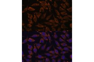 Immunofluorescence analysis of L929 cells using NOTCH2 antibody (ABIN6132419, ABIN6144736, ABIN6144737 and ABIN6213887) at dilution of 1:100. (NOTCH2 antibody  (AA 2242-2471))