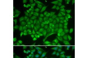Immunofluorescence analysis of MCF-7 cells using RAB11A Polyclonal Antibody (RAB11A antibody)