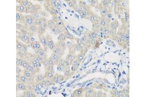 Immunohistochemistry of paraffin-embedded Rat liver using PYCR1 Polyclonal Antibody at dilution of 1:200 (40x lens). (PYCR1 antibody)