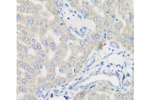 Immunohistochemistry of paraffin-embedded Rat liver using PYCR1 Polyclonal Antibody at dilution of 1:200 (40x lens).