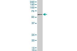 CPT2 polyclonal antibody (A01), Lot # TTB0060412QCS1 Western Blot analysis of CPT2 expression in IMR-32 . (CPT2 antibody  (AA 351-450))