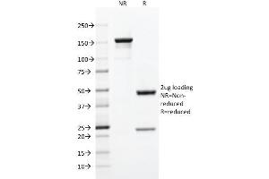 SDS-PAGE Analysis Purified CD5 Mouse Monoclonal Antibody (C5/473).