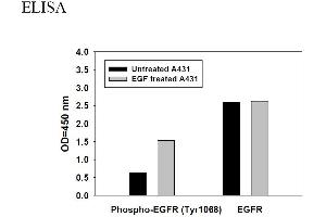 Image no. 4 for Epidermal Growth Factor Receptor (EGFR) ELISA Kit (ABIN1981744)