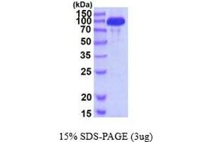 SDS-PAGE (SDS) image for Hexokinase 3 (White Cell) (HK3) protein (His tag) (ABIN668034) (HK3 Protein (His tag))