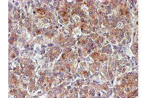 Image no. 3 for anti-NADH Dehydrogenase (Ubiquinone) Complex I, Assembly Factor 7 (NDUFAF7) antibody (ABIN1499667) (NDUFAF7 antibody)