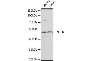 Western blot analysis of extracts of various cell lines using NPTN Polyclonal Antibody at dilution of 1:1000. (NPTN antibody)