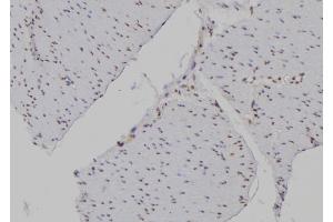 ABIN6277194 at 1/100 staining Human gastric tissue by IHC-P. (Histone 3 antibody  (H3K4me3))