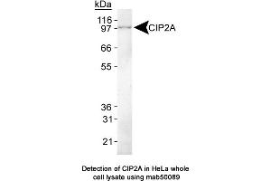 Image no. 1 for anti-KIAA1524 (KIAA1524) (C-Term) antibody (ABIN363243) (KIAA1524 antibody  (C-Term))