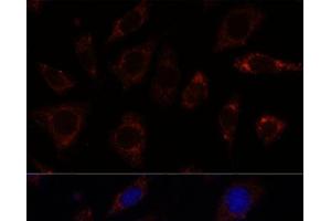 Immunofluorescence analysis of L929 cells using TBRG4 Polyclonal Antibody at dilution of 1:100. (TBRG4 antibody)