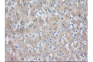 Immunohistochemical staining of paraffin-embedded Human liver tissue using anti-NIT2 mouse monoclonal antibody. (NIT2 antibody)