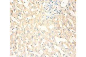 Immunohistochemistry of paraffin-embedded human liver tissue using ABIN7159537 at dilution of 1:100