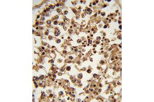 Immunohistochemistry (IHC) image for anti-Ets Variant 6 (ETV6) antibody (ABIN3003964) (ETV6 antibody)