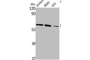 Western Blot analysis of Jurkat K562 NIH-3T3 cells using PLK-5 Polyclonal Antibody (PLK5 antibody  (Internal Region))