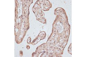 Immunohistochemistry of paraffin-embedded human placenta using TLK1 antibody (ABIN7270859) at dilution of 1:100 (40x lens). (TLK1 antibody  (AA 160-230))