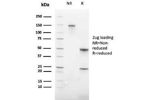 SDS-PAGE Analysis Purified CD235a Recombinant Rabbit Monoclonal Antibody (GYPA/3219R).