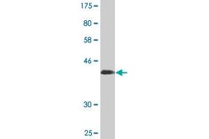 Western Blot detection against Immunogen (41. (ROBO3 antibody  (AA 1-147))