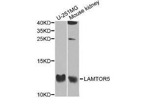 Western blot analysis of extracts of various cell lines, using LAMTOR5 antibody. (HBXIP antibody  (AA 1-173))
