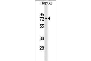 ZN Antibody (Center) (ABIN1537955 and ABIN2849970) western blot analysis in HepG2 cell line lysates (35 μg/lane). (ZNF614 antibody  (AA 174-200))