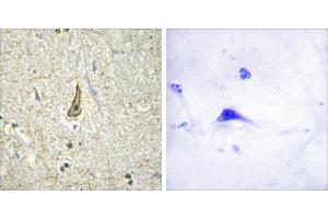 Peptide - +Immunohistochemistry analysis of paraffin-embedded human brain tissue using Cytochrome P450 26C1 antibody. (CYP26C1 antibody)