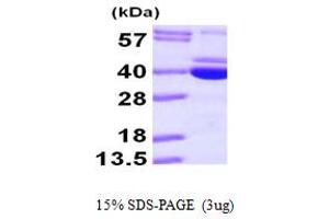 SDS-PAGE (SDS) image for Pyridoxal Kinase (PDXK) (AA 1-312) protein (His tag) (ABIN667835)