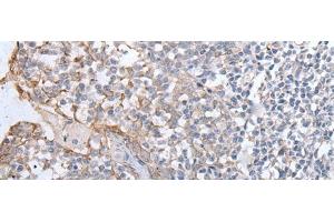 Immunohistochemistry of paraffin-embedded Human tonsil tissue using GPD2 Polyclonal Antibody at dilution of 1:40(x200) (GPD2 antibody)